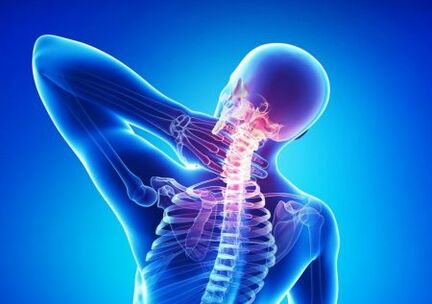 sintomas de osteocondrose cervical