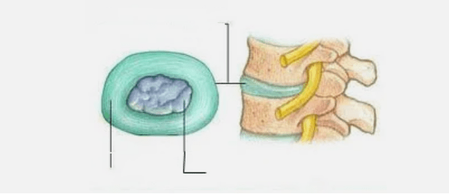Natureza da osteocondrose