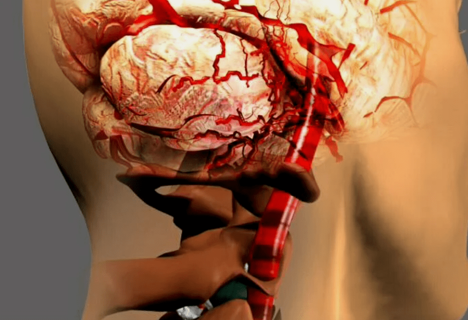 do que a osteocondrose cervical é perigosa