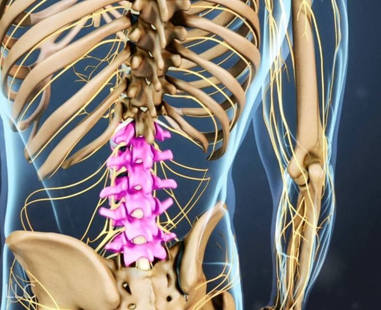 Osteocondrose da coluna lombar